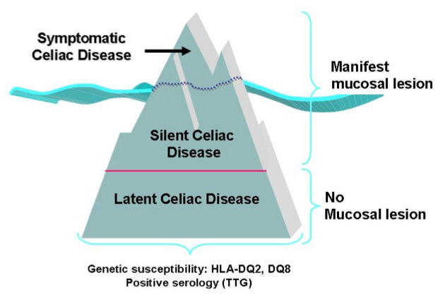 celiachia-2