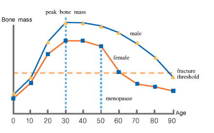 grafico decadimento osseo